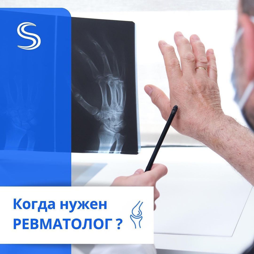 Кто такой врач-ревматолог? | Uniserv Medical Center